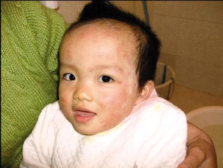 强生润肤霜致幼儿过敏仅赔600称产品合格(图)