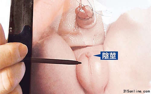 男婴生殖器约0.2厘米长(笔指处),一粒米大小,不到平均长度2.9厘米的十分之一。图片来源:台湾媒体 男婴生殖器约0.2厘米长(笔指处),一粒米大小,不到平均长度2.9厘米的十分之一。图片来源:台湾媒体