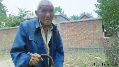 百岁老人手背长角10年医生称其患“皮角”皮肤病