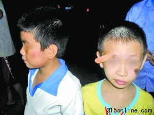 8岁学生称遭老师扇耳光致眉角开裂皮肉外翻(图)
