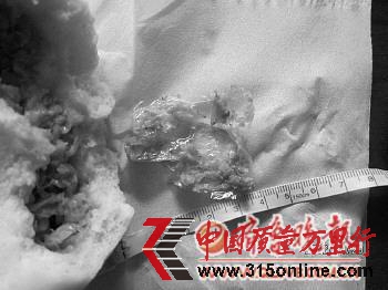 ▲图为包子中吃出的塑料袋(陈女士提供)。 ▲图为包子中吃出的塑料袋(陈女士提供)。