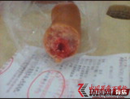 天瑞祥火腿咬出“色素块” 天瑞祥火腿咬出“色素块”
