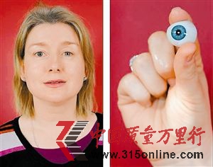斯通左眼摘除后安装了假体眼球。 斯通左眼摘除后安装了假体眼球。